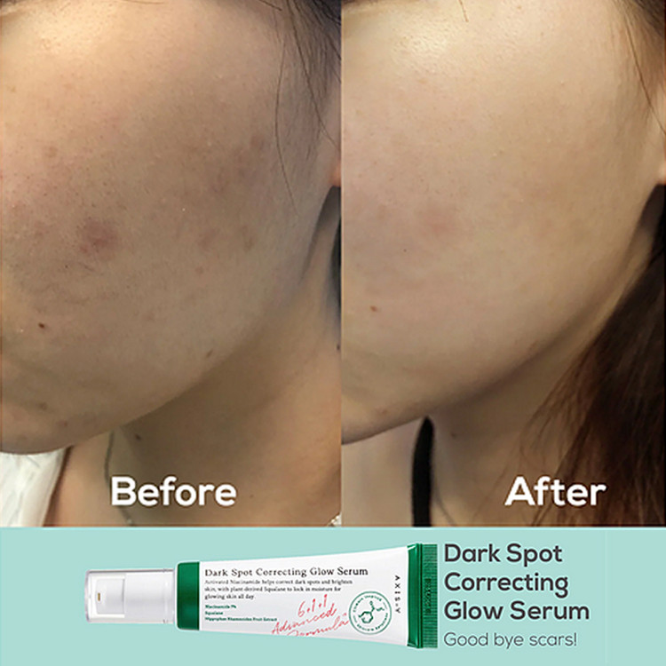 سرم ضدلک AXIS-Y دارک اسپات | روشنکننده قوی و از بینبرنده جای جوش